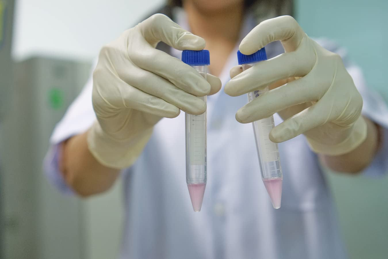 Ackers Conical Centrifuge Tubes 15Ml, 100 Pcs Sterile Plastic Test Tubes with Screw Caps, Polypropylene Container with Graduated and Write-On Spot, Non-Pyrogenic, Dn/Rnase Free