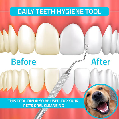 Professional Dental Tartar Scraper Tool, Dental Pick, 6.5 Inch Double Ended Tartar Remover for Teeth, Plaque Remover, Tooth Scraper, Silver, 1 Piece